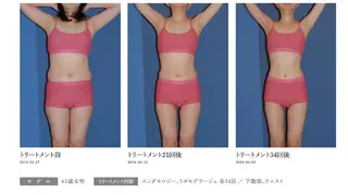 オレンジバナナ 新潟店のエステ・リラクイメージ