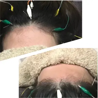 かすがい鍼灸院 Re.heartのエステ・リラクイメージ