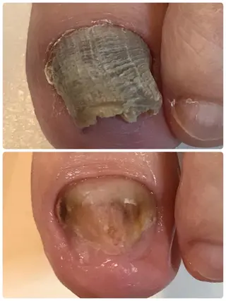 ネイル 冨澤 ひろみのネイルデザイン