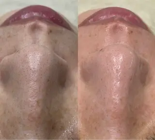 毛穴に特化したサロン MYFAIRLADYのエステ・リラクイメージ