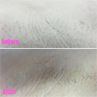 肌ケア＆毛穴洗浄 Cheri/女性専用のエステ・リラクイメージ