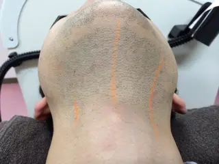 メンズ ☀️Akala☀️ メンズ脱毛のエステ・リラクイメージ