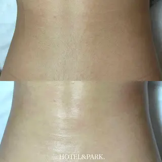 HOTEL&PARK .Moeワックス脱毛のエステ・リラクイメージ