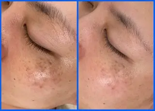 メンズ プライベートサロン アオラのネイルデザイン