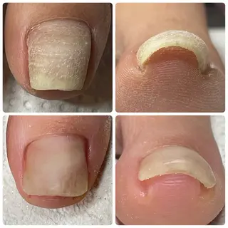 gorella Ａのネイルデザイン