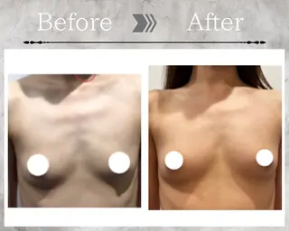 Feliz(ユーカリレンタルサロン内)所属・【バストケアサロン】 Feliz フェリスのエステ・リラクイメージ