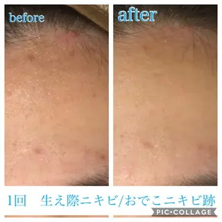 セミロング カラー パーマ ヘアアレンジ メンズ キッズ ネイル マツエク・マツパ EnsorClair 代表　野口真央のエステ・リラクイメージ