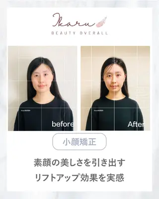 ikaru美容整体 池袋のエステ・リラクイメージ