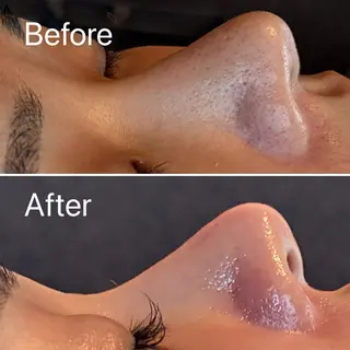 LIKO フェイシャル&ボディのエステ・リラクイメージ