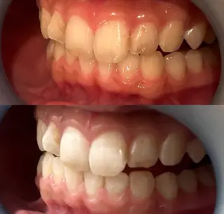 【Beauel】 ここあのエステ・リラクイメージ