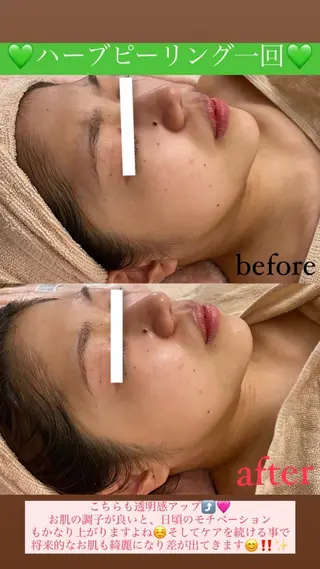 メンズ Salon de Lino 御器所のエステ・リラクイメージ