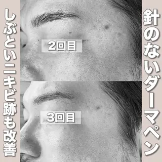 mone~total care salon~所属・mone (モーネ)のエステ・リラクイメージ