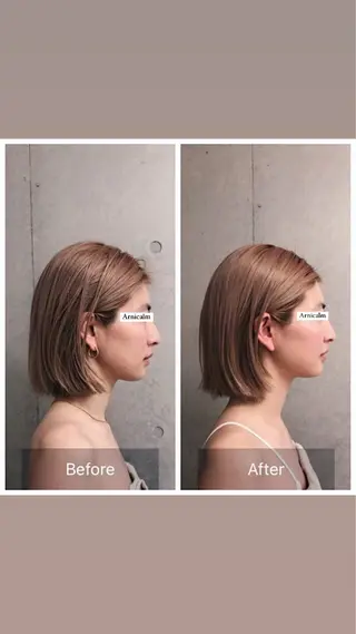 ハーブピーリング 肌再生ピーリング/のエステ・リラクイメージ