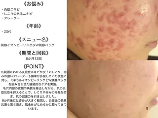 3か月で肌革命👼 ニキビ専門店💫のエステ・リラクイメージ