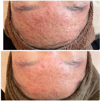 esthesalon O'-en-のエステ・リラクイメージ