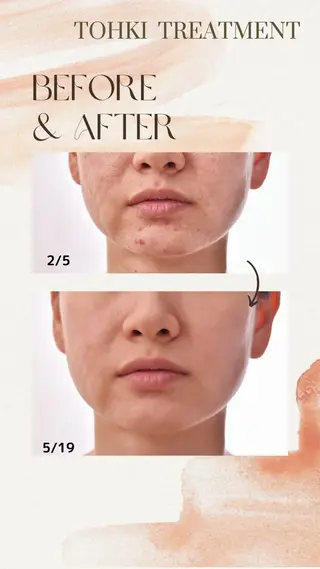 トラブル肌改善🏥 Meow！🫧🫧のその他イメージ