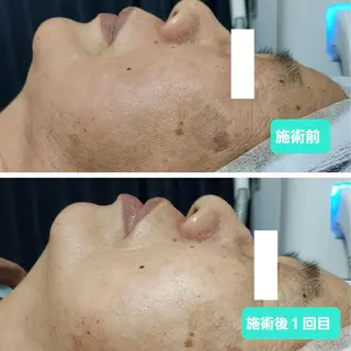 別府脱毛サロン Grandeのエステ・リラクイメージ