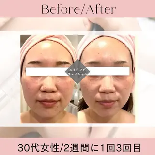 痩身&小顔サロン EXTREMITYのエステ・リラクイメージ