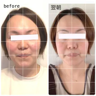 小顔矯正ドライヘッド Arincoのエステ・リラクイメージ