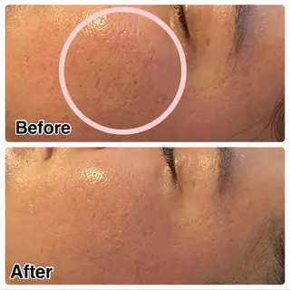 🌴Beauty Salon LANAのエステ・リラクイメージ