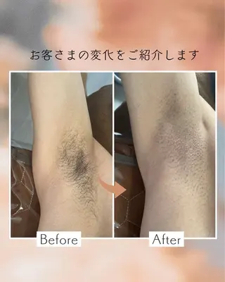 春日部 リダージュのエステ・リラクイメージ