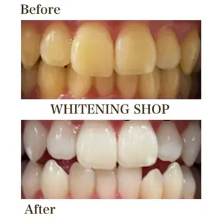 ホワイトニング ショップ伊丹店のその他イメージ