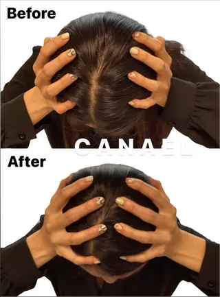 頭蓋骨から小さくする 小顔★専門サロンのエステ・リラクイメージ