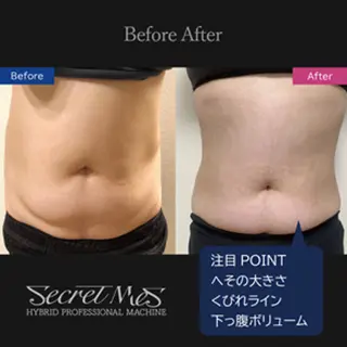 伊藤 正美のマツエク・マツパデザイン