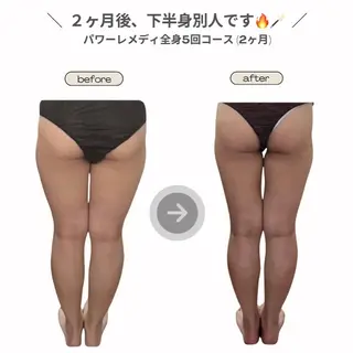 《本気痩せ×疲労改善 》  BILOOPのエステ・リラクイメージ