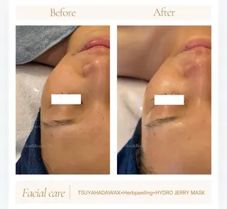 艶肌ワックス ALLY.のエステ・リラクイメージ