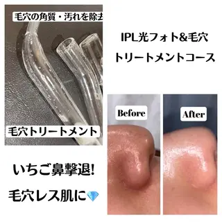 セミロング カラー パーマ ヘアアレンジ メンズ キッズ ネイル マツエク・マツパ アイブロウ Chloe-クロエ- 脱毛/フェイシャルのエステ・リラクイメージ