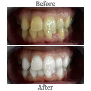 セルフホワイトニング　エクシア相模大野店所属・mo moのその他イメージ