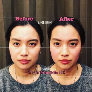 きらめきワンライフ Yumaのエステ・リラクイメージ