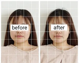 桜井市｜小顔・ 美容矯正 madoiのエステ・リラクイメージ