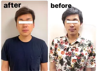 メンズ ハーブピーリング🌿 脱毛🧡ヘッドスパのエステ・リラクイメージ