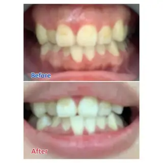 M渋谷 ホワイトニングのエステ・リラクイメージ