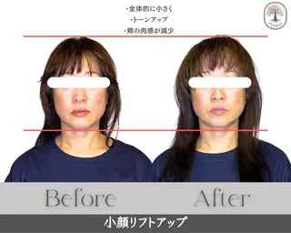 ヘッドスパ・小顔矯正 十色　横浜のエステ・リラクイメージ