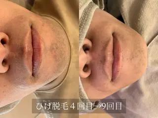 脱毛サロン Arumのエステ・リラクイメージ