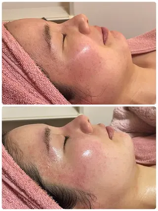 肌質改善専門店/絹々(きぬ)所属・心満たされる ハーブピーリング絹々のエステ・リラクイメージ