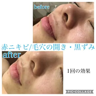 セミロング カラー パーマ ヘアアレンジ メンズ キッズ ネイル マツエク・マツパ EnsorClair 代表 野口真央のエステ・リラクイメージ