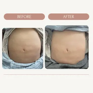 colon salonのエステ・リラクイメージ