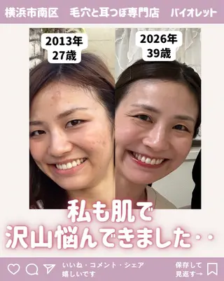 毛穴と耳つぼ専門店 バイオレット　りののその他イメージ