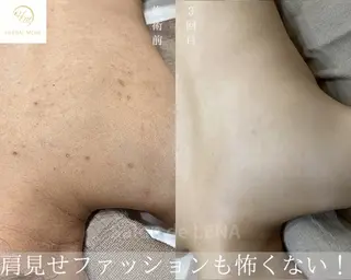 ハーブピーリング専門 サロンドレナ平岡のエステ・リラクイメージ