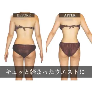 痩身エステ✨ Julien千葉店✨のエステ・リラクイメージ