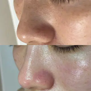 毛穴ケア・ヘッドスパ サロンSHINYのエステ・リラクイメージ