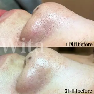 上坂 祐以のエステ・リラクイメージ