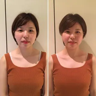 即小顔♥️美容鍼× ハーブピーリングのその他イメージ