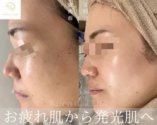 ハーブピーリング専門 サロンドレナ　白藤のエステ・リラクイメージ