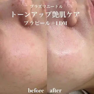 韓国肌管理&小顔 ＩＲＯＨＡのエステ・リラクイメージ