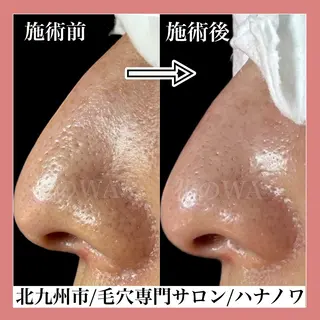 毛穴&リンパマッサー ジ専門サロン花のWAのエステ・リラクイメージ